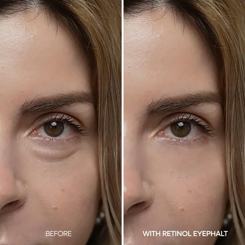 [Cuidado de día y de noche] Línea para levantar bolsas de los ojos Eyephalt - Image 17