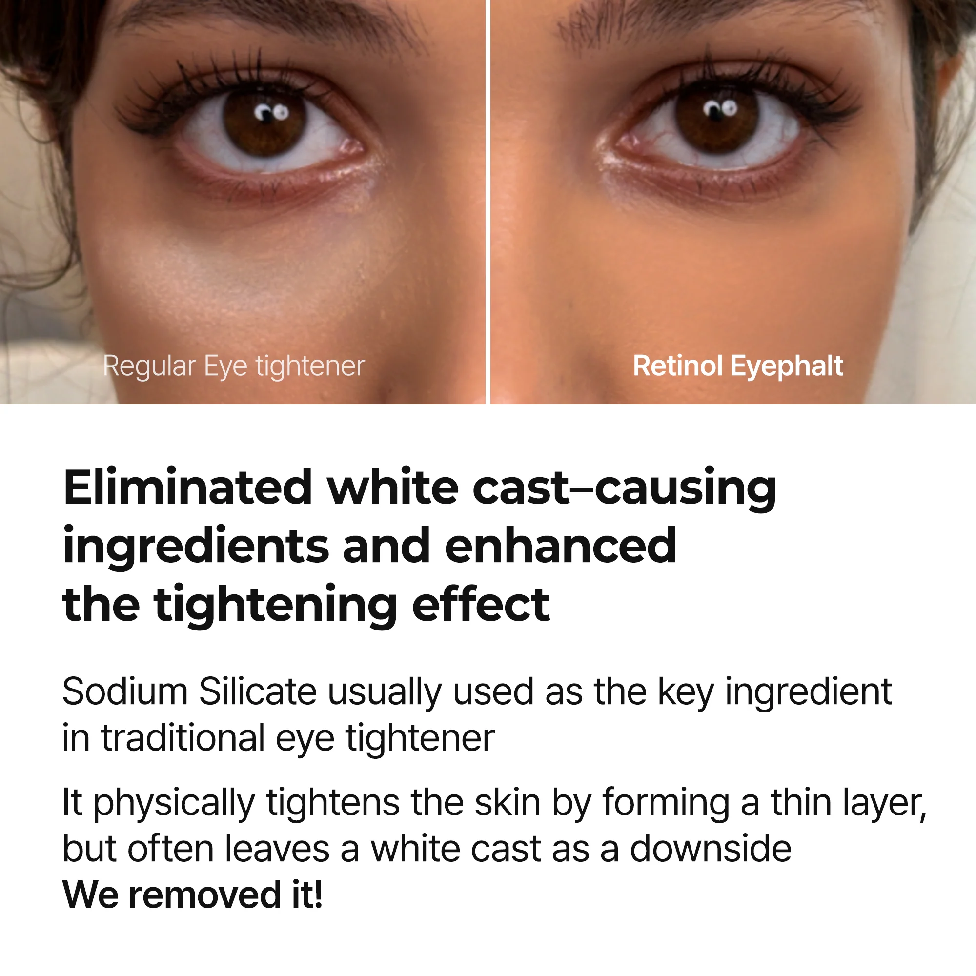 [Cuidado de día y de noche] Línea para levantar bolsas de los ojos Eyephalt - Image 19