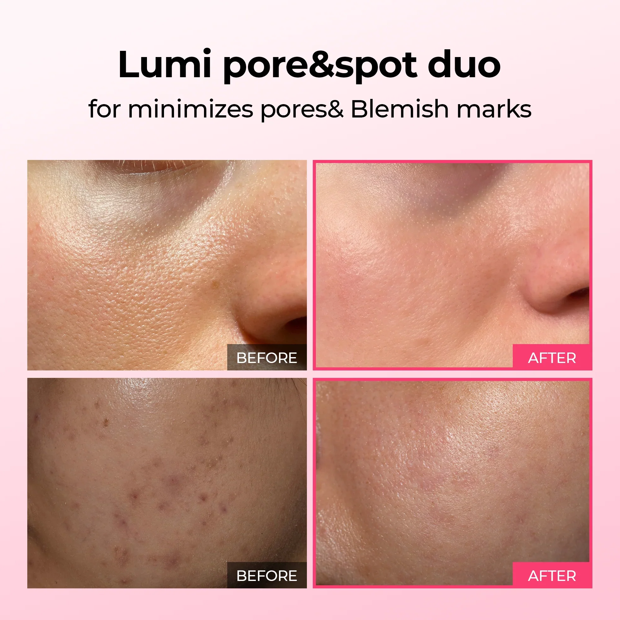 Piel de Cristal en 7 Días — Rutina Coreana de 3 Pasos - Image 2