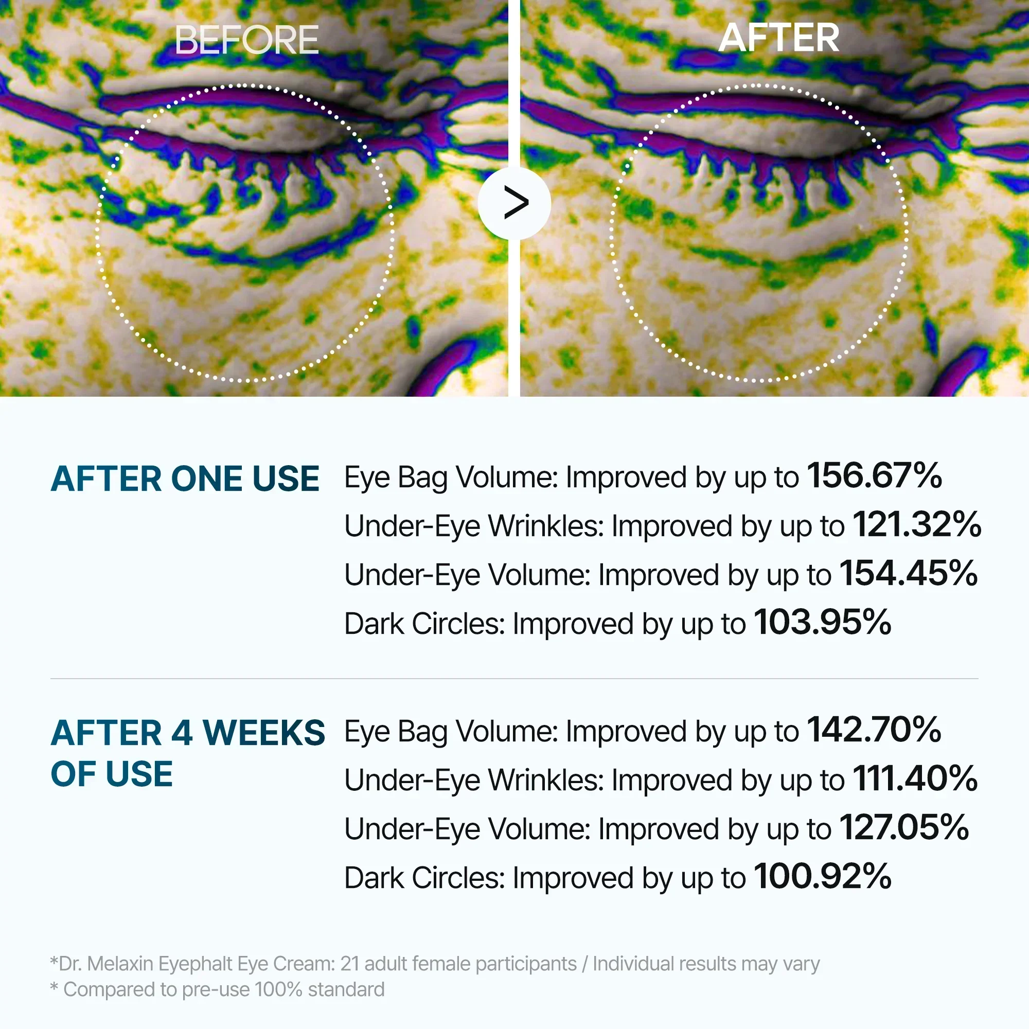 Crema para bolsas de ojos Eyephalt - Image 8