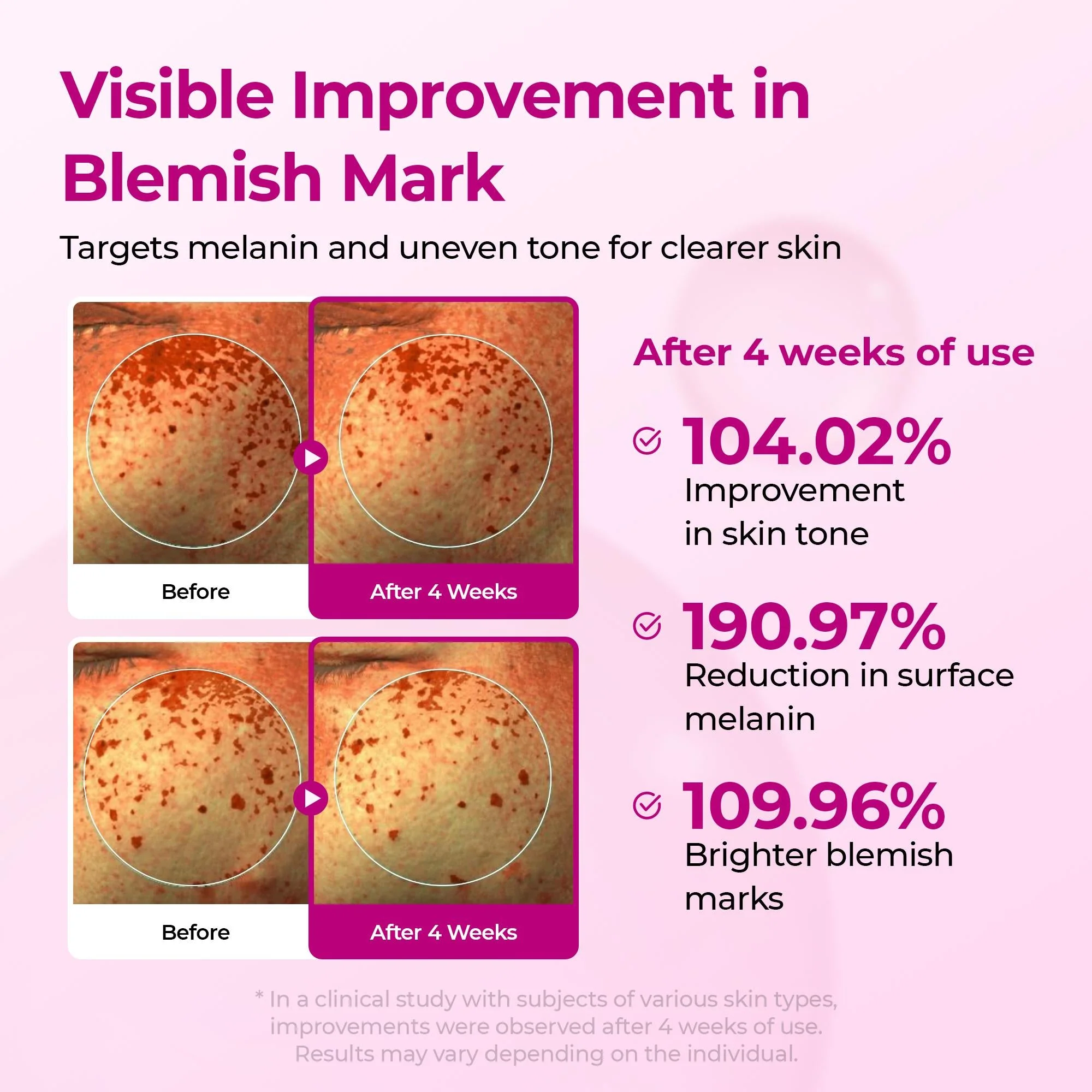 Set de 5 piezas para reafirmar y densificar la piel, lifting facial y de cuello – Edición Primavera - Image 10