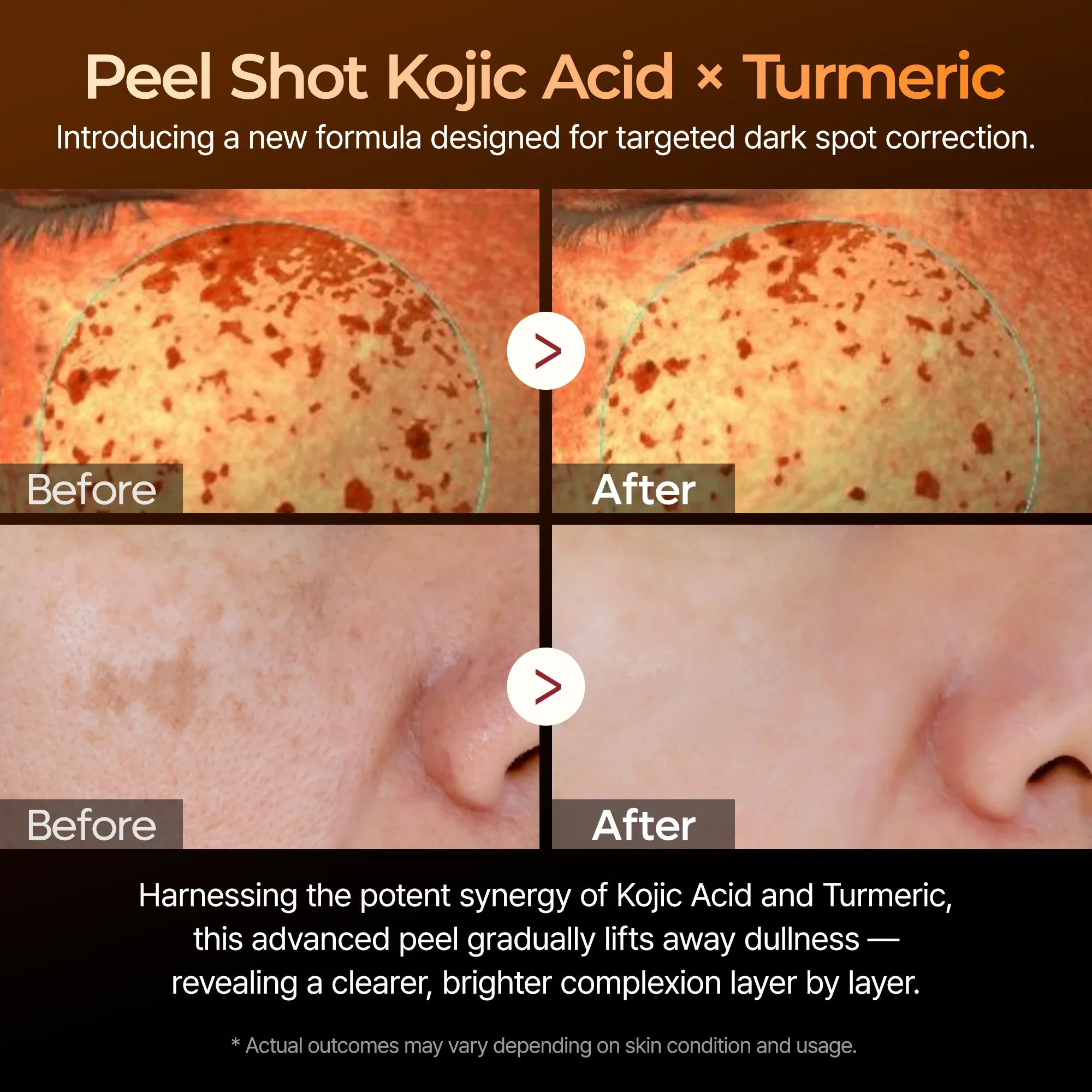 Suero de cúrcuma y ácido kójico Peel Shot - Image 3