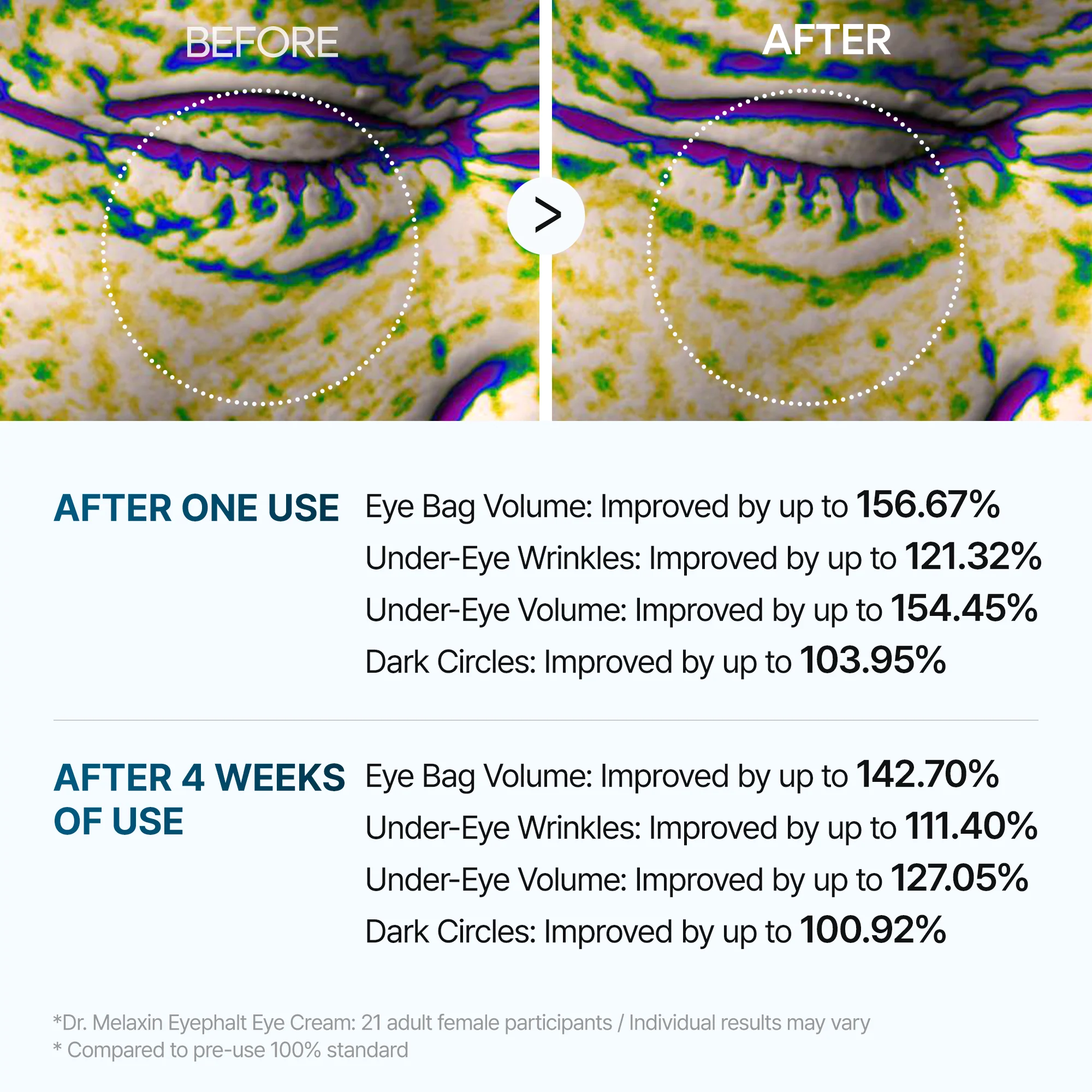 Eyephalt Lifting Duo – Tratamiento reafirmante y antihinchazón para el contorno de ojos - Image 5
